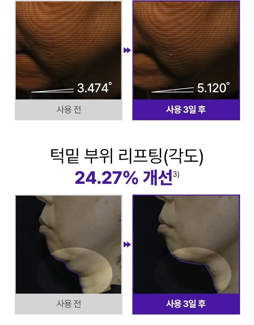 [탄력&리프팅 패치] 더마펌 스킨 텐션 리프팅 패치 500 (턱전용 4+2매) 상세페이지 20